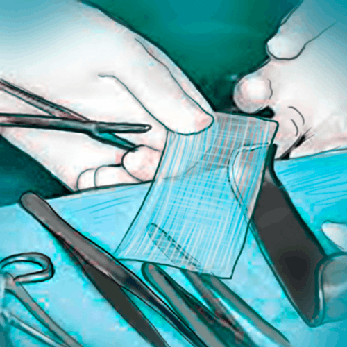 Materials used in hernia surgery